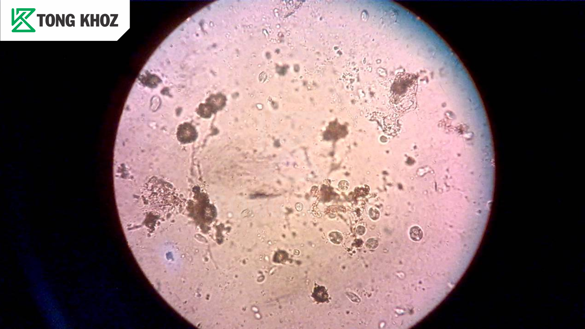 Nấm Phytophthora infestans