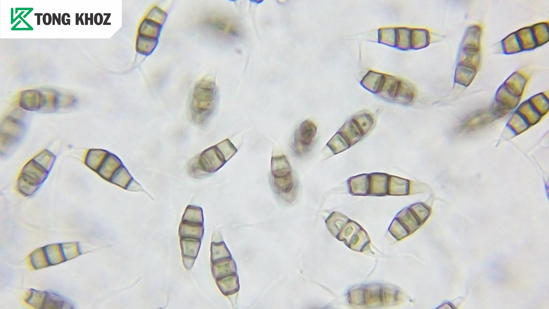 Nguyên nhân bệnh ghẻ trái ổi 