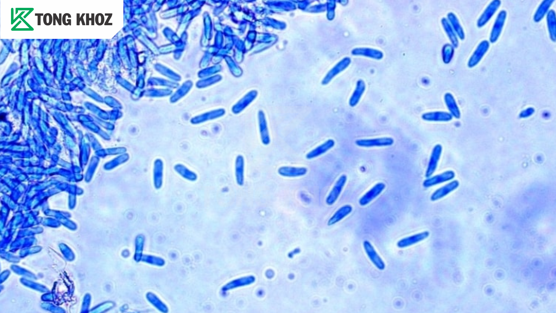 Nguyên nhân bệnh thán thư trên ổi