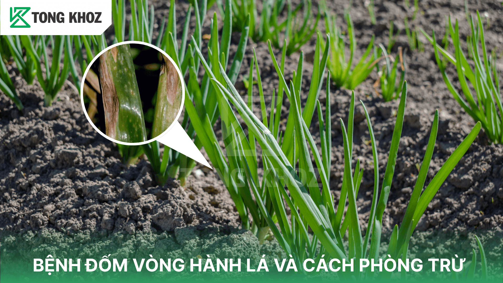 BỆNH ĐỐM VÒNG HÀNH LÁ VÀ CÁCH PHÒNG TRỪ
