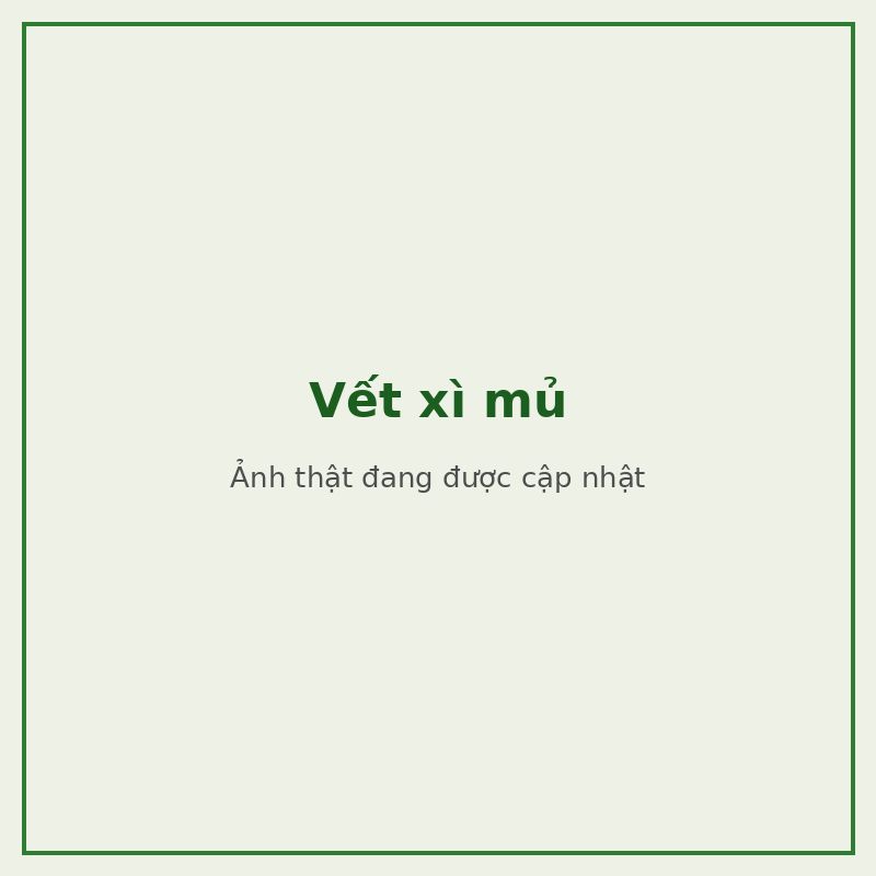 Vết xì mủ — đối tượng combo phòng trị